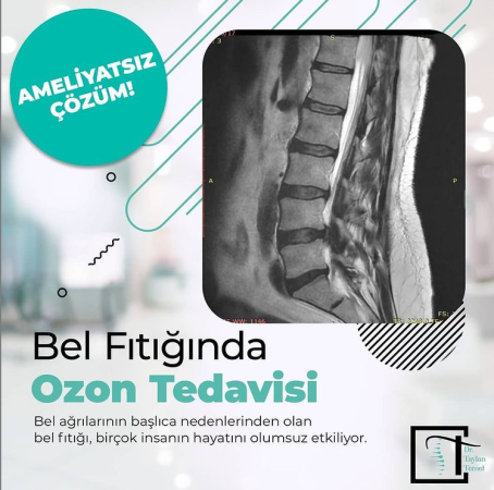 Bel fıtığında ozon tedavi