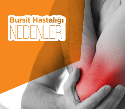 Bursit hastalığı nedenleri