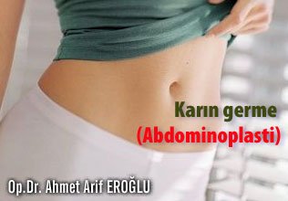Karın germe ( abdominoplasti)