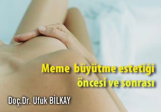 Meme  büyütme estetiği öncesi ve sonrası