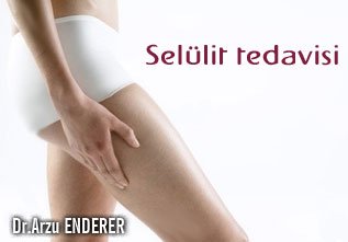 Selülit tedavisi !