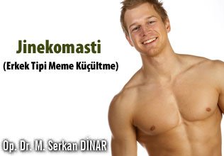 Jinekomasti - erkek tipi meme küçültme