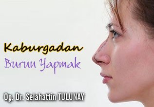 Kaburgadan burun yapmak