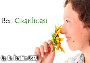 Ben çıkarılması