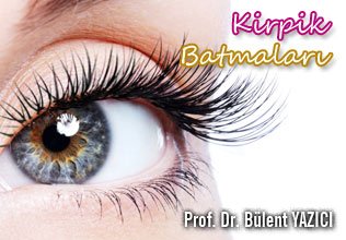 Kirpik batmaları