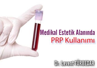 Cilt gençleştirmede prp kullanımı