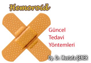 Hemoroid'te güncel tedavi yöntemleri