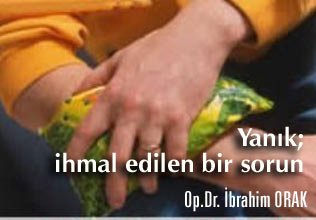 Yanık; ihmal edilen bir sorun