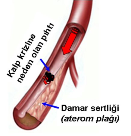 Kolesterol konusunda doğrular nedir ?