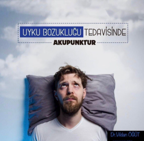Uyku bozuklugu tedavısınde akupunktur: