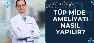 Tüp mide ameliyatı nasıl yapılır? Önemli noktaları nelerdir?