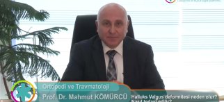 Halluks Valgus deformitesi neden olur? Nasıl tedavi edilir?