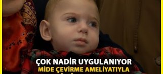 Laparoskopik yöntemle mide çevirme ameliyatı, gastroözofajial reflü