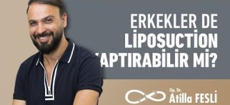 Erkekler De Liposuction Yaptırabilir Mi?