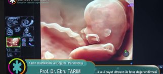 3 ve 4 boyut ultrason ile fetus değerlendirmesi