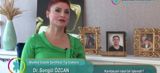 Kavitasyon nasıl bir işlemdir?