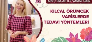 Çok İnce Kılcal Örümcek Varisler Mi? Gidin Hayatımızdan🤩