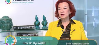 Sedef hastalığı hakkında