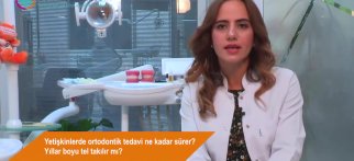Yetişkinlerde ortodontik tedavi ne kadar sürer? Yıllar boyu tel takılır mı?