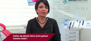 Çekilen diş etlerinin tekrar yerine gelmesi mümkün müdür?