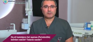 Diş eti hastalığının ileri aşaması (Periodontitis)  belirtileri nelerdir? Tedavisi nasıldır?