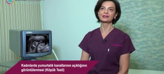 Kadınlarda yumurtalık kanallarının açıklığının  görüntülenmesi (Köpük Testi)