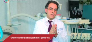 Ortodonti tedavisinde diş çekilmesi gerekir mi?