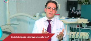 Diş telleri dişlerde çürümeye sebep olur mu?
