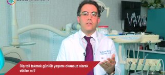 Diş teli takmak günlük yaşamı olumsuz olarak etkiler mi?