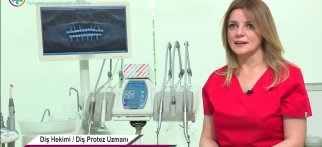 Laminate Veneerin özellikleri nelerdir? Kimlere uygulanmaktadır?
