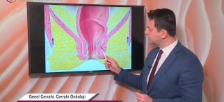 Anal fistül nedir? Tedavisi nasıl yapılır?