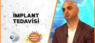 İmplant Tedavisi | Dt. Erdinç Kılıç | Hayat Sağlıklı Güzel