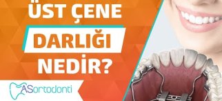 Üst Çene Darlığı Nedir? | AS Ortodonti