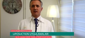 Op. Dr. Sadullah Karun - Liposuction Uygulamaları