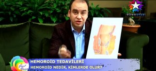 Güzel Yaşam, Hemoroid, EuroStar