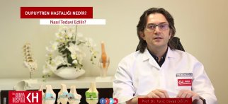 Dupuytren Hastalığı