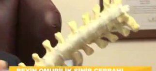 Youtube - Boyun fıtığında belirtiler nasıl oluşur?