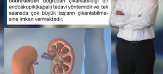 Youtube - Büyük böbrek taşları
