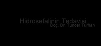 Youtube - Hidrosefalinin tedavisi