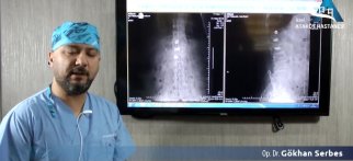 Youtube - Vertebroplast yani Omurga iltihabı!