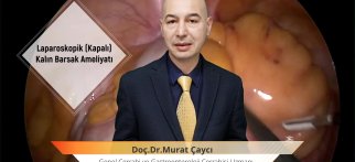 Youtube - Kolon kanseri ve Laparoskopik ameliyat nelerdir?