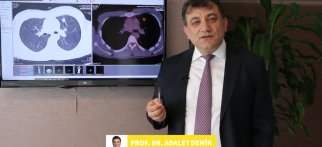 Youtube - Akciğerde Nodül nedir? Tedavisi nasıl yapılmaktadır?