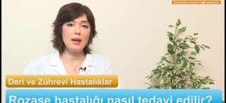 Rozase hastalığı nasıl tedavi edilir?