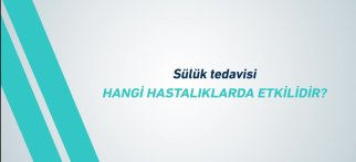 Youtube - Sülük tedavisi hangi hastalıklarda etkilidir?