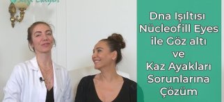 Dna Işıltısı / Nücleofill Eyes ile Göz Altı ve Kaz Ayakları Sorunlarına Çözüm