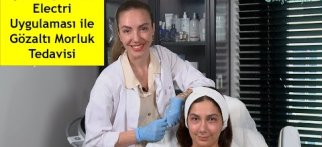 Işık Dolgusu ve Electri Uygulaması ile Gözaltı Morluk Tedavisi