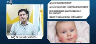 Alerjik Hastalıklara Sebep Olan Çevresel Faktörler Nelerdir?