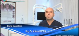 İmplant çeşitleri nelerdir?