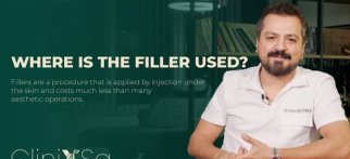 Where is the filler used? • Dr. Sinan Akyürek