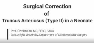 Surgical Correction of Truncus Arteriosus (Type II) in a Neonate